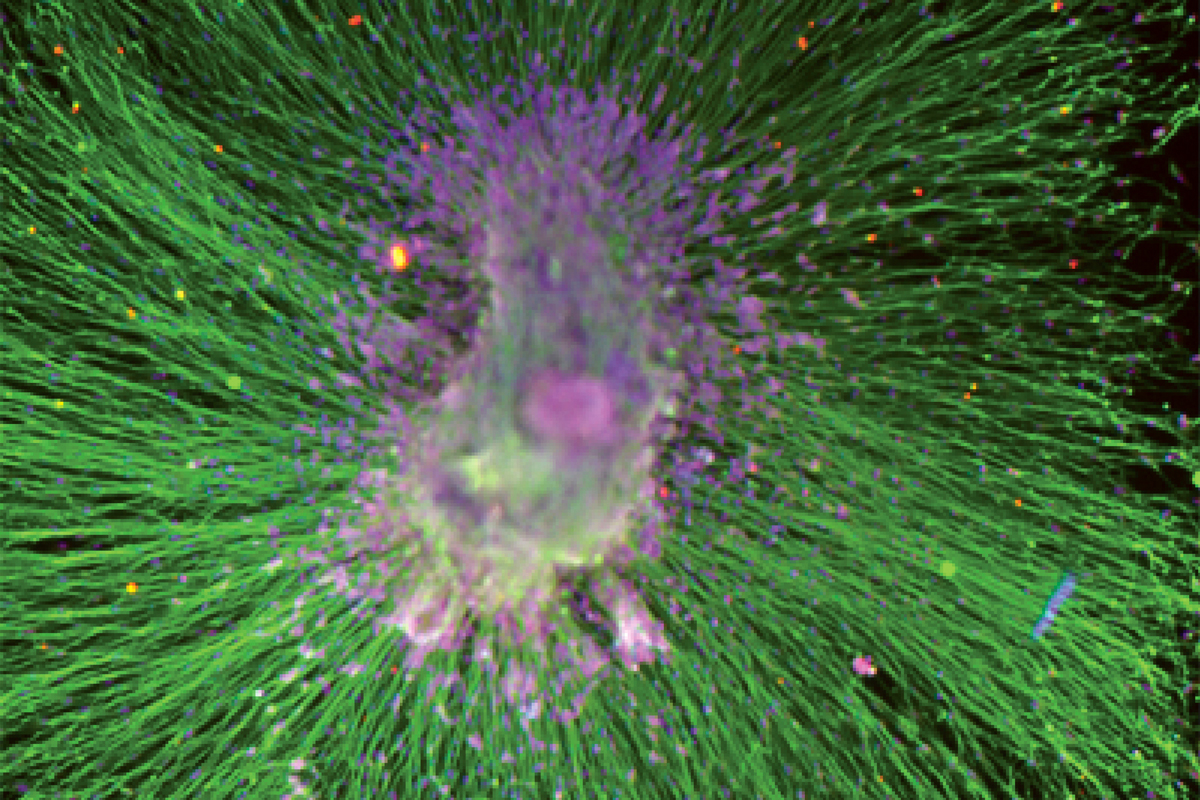 Immature nerve cells generated from induced pluripotent stem cells by cell engineering. Memorial Sloan Kettering researchers are at the forefront of developing cell-based therapies for cancer and other diseases, including central nervous system disorders. 